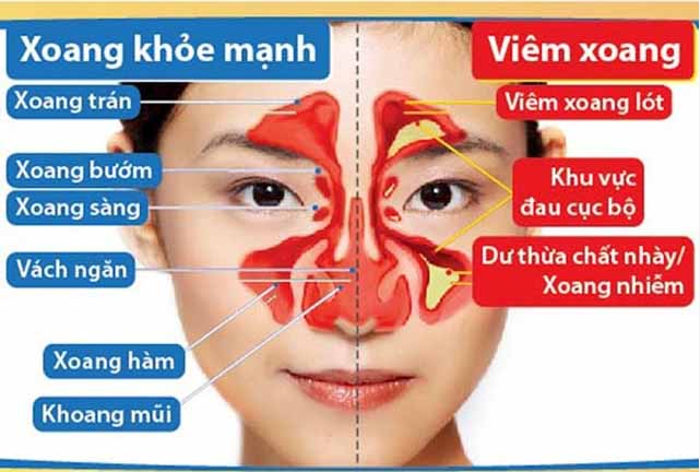 Thực phẩm chức năng pháp